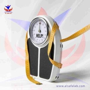 Weight Loss Blood Panel