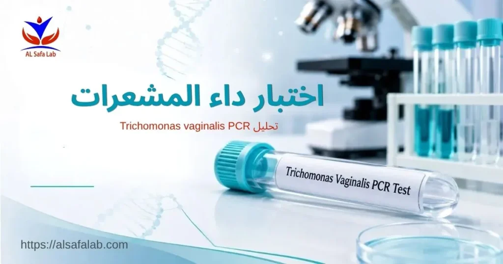 اختبار داء المشعرات