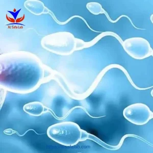 Anti-Sperm Antibody Test