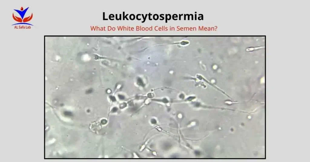 Leukocytospermia