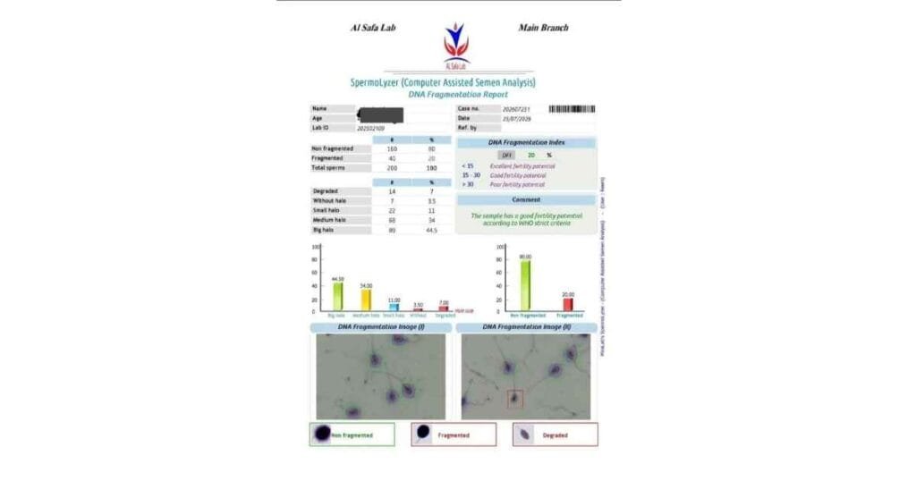 كيفية قراءة تحليل DNA Fragmentation